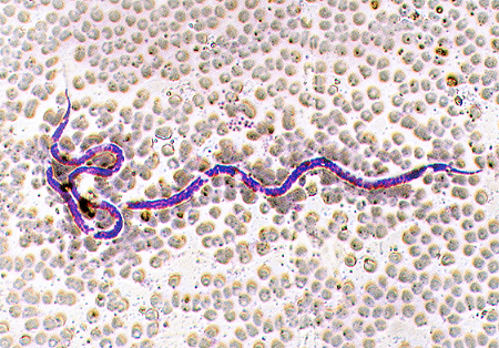 フィラリア感染犬の血液中にみられる ミクロフィラリア(顕微鏡写真)